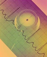 EKG-diagram és szetoszkóp, hirtelen szívhalál, szívroham EKG-diagram és szetoszkóp, hirtelen szívhalál, szívroham