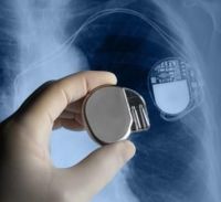 pacemaker szívritmus-szabályozó