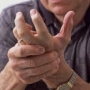 rheumatoid arthritis