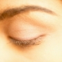 szívroham, xanthelasma szívroham, xanthelasma