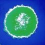 HIV